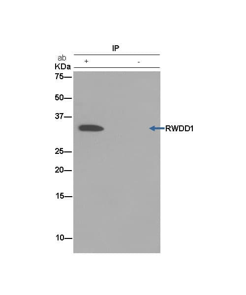 Rwdd1 Antibody Epr13715b Ab181994  Immunoprecipitation Img907