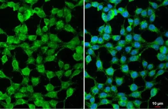 Anti-SARM antibody(AB226930)