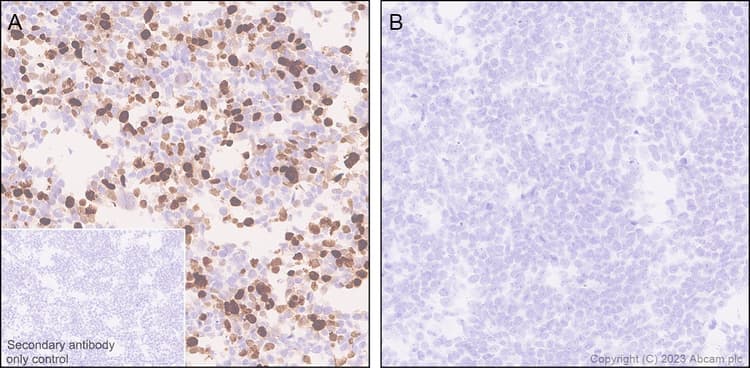Anti-MATH2/NEUROD6 antibody [EPR28660-23](AB315812)