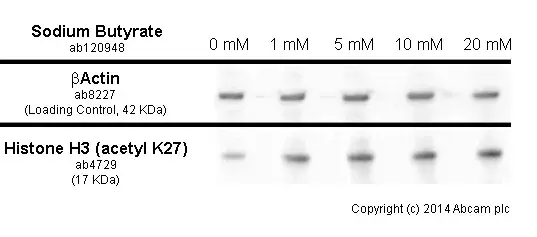 Anti-Histone H3 (acetyl K27) antibody - ChIP Grade(AB4729)