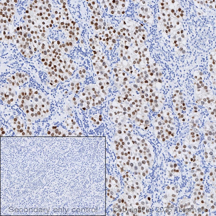 Anti-Oct4 antibody [EPR17929] - ChIP Grade(AB181557)