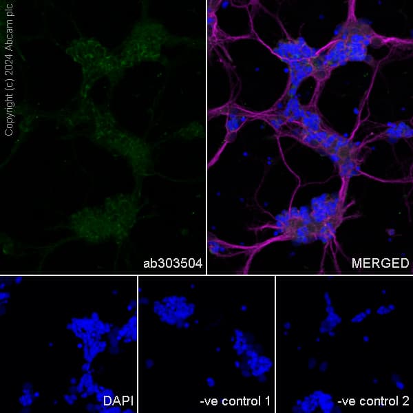Anti-ABCA4 antibody [EPR26543-66](AB303504)