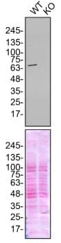 Tls Fus Antibody Epr5812 Ab124923  Western Blot Img181525