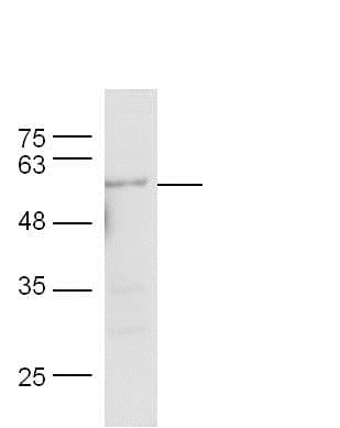 Anti-Nicotinic Acetylcholine Receptor alpha 7 antibody(AB216485)