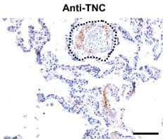 Universal HIER antigen retrieval reagent (10X)(AB208572)