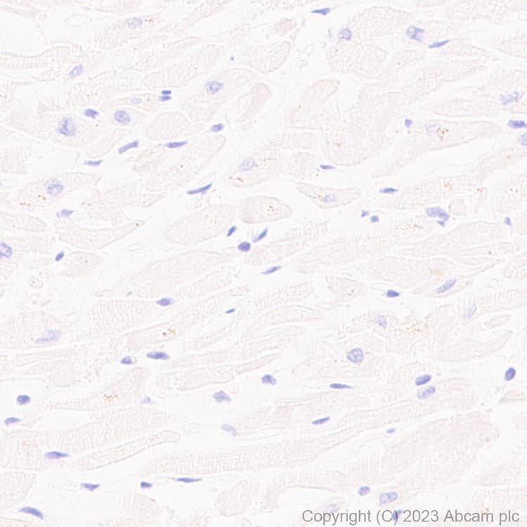Anti-Sez6 antibody [EPR28518-55](AB314233)