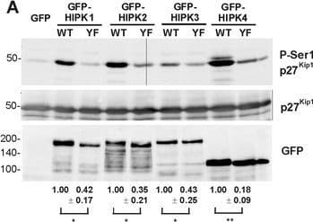 P27 Kip 1 Phospho S10 Antibody Ep2332y Ab62364  Western Blot Img442164