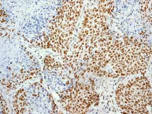 Anti-Cdk9 antibody [EPR3119Y](AB76320)