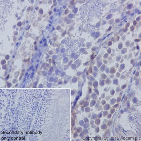 Anti-Huntingtin antibody [EPR5526](AB109115)