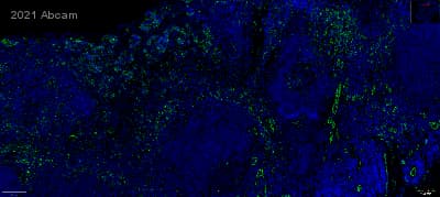 Anti-CD31 antibody [RM1006](AB281583)