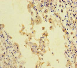 Stil Sil Antibody Ab222838  Immunohistochemistry Formalin Pfa Fixed Paraffin Embedded Sections Img54966