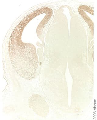 Anti-FOXG1 antibody(AB18259)