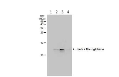 Beta 2 Microglobulin Antibody Ab227261  Western Blot Img450487
