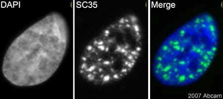Anti-SC35 antibody [SC-35] - Nuclear Speckle Marker(AB11826)