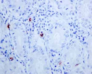 Anti-Mast Cell Tryptase antibody [EPR8475](AB134931)