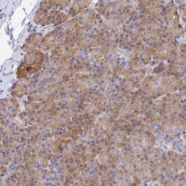 Spata5l1 Antibody Ab126354  Immunohistochemistry Formalin Pfa Fixed Paraffin Embedded Sections Img38613