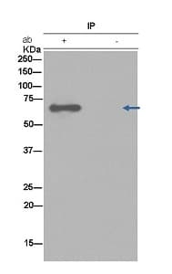 Anti-Choline Acetyltransferase antibody [EPR13024(B)](AB181023)