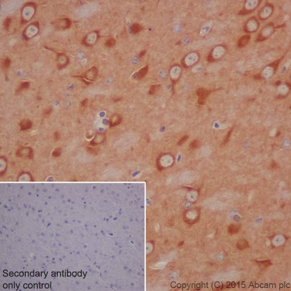 Anti-DRP1 antibody [EPR19274](AB184247)