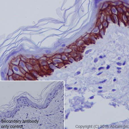 Aquaporin 3 Antibody Epr19932 Ab215853  Immunohistochemistry Formalin Pfa Fixed Paraffin Embedded Sections Img101037