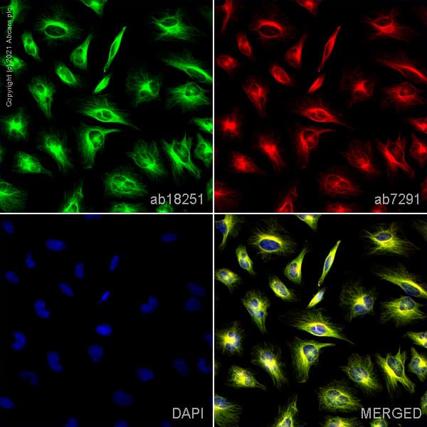 Anti-alpha Tubulin antibody - Microtubule Marker(AB18251)