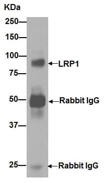 Anti-LRP1 antibody [EPR3724](AB92544)