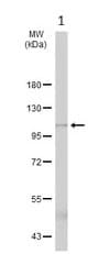 Anti-ADAM10 antibody(AB227172)