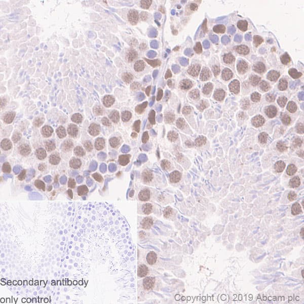 Smarcd2 Antibody Epr20860 251 Ab220164  Immunohistochemistry Formalin Pfa Fixed Paraffin Embedded Sections Img103894