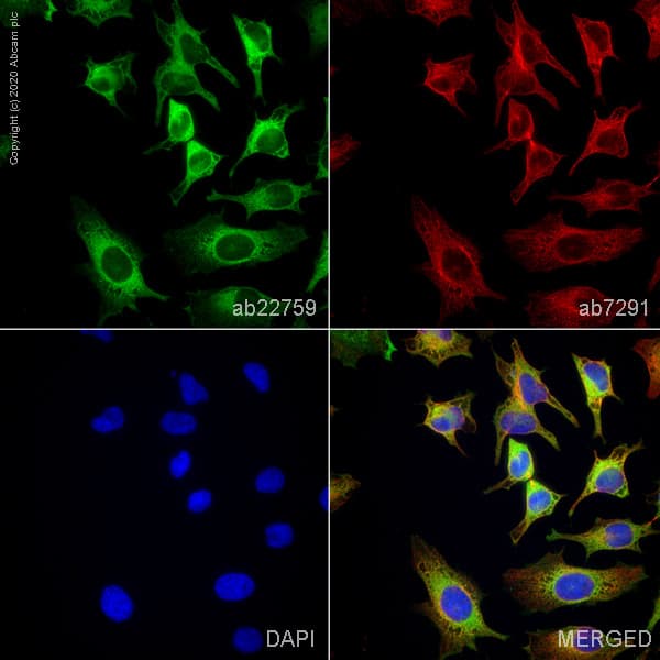 Fatty Acid Synthase Antibody Ab22759  Immunocytochemistry Img120429