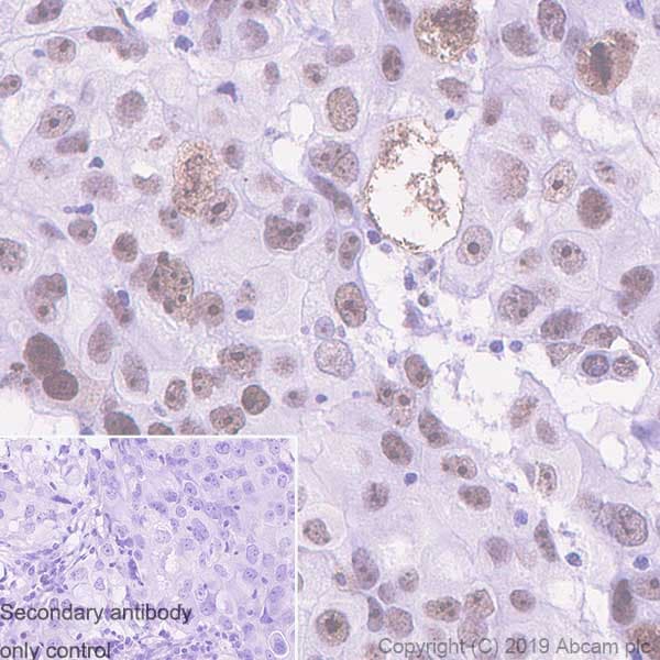 Ddx21 Antibody Epr14495 Ab182156  Immunohistochemistry Formalin Pfa Fixed Paraffin Embedded Sections Img66040