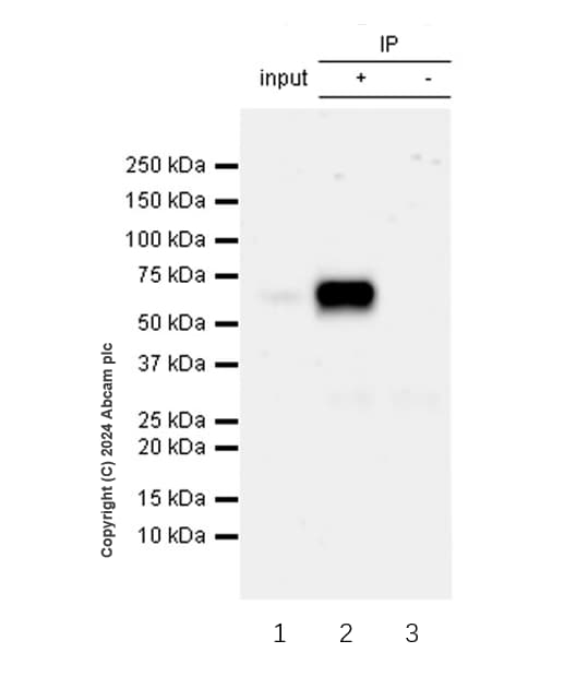 Rbpjk Antibody Rm2045 Ab317048  Immunoprecipitation Img432229