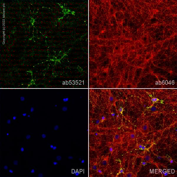 Anti-beta Tubulin antibody - Loading Control(AB6046)