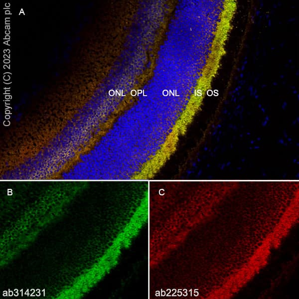 Anti-RS1 antibody [EPR28513-78](AB314231)