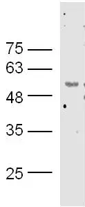 Anti-Catalase antibody(AB217793)