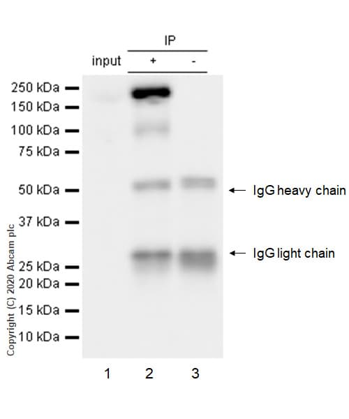 Anti-APC antibody [EP701Y](AB40778)