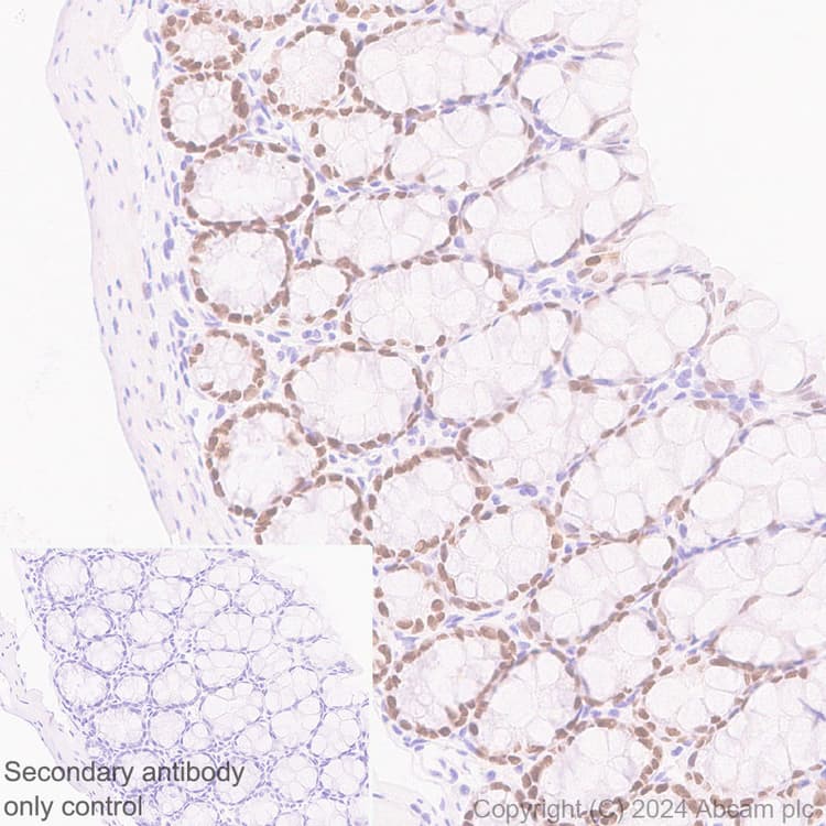 Anti-FOXA1 antibody [RM1119](AB317046)