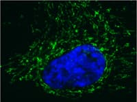 Anti-Pyruvate dehydrogenase E2/E3bp antibody [13G2AE2BH5](AB110333)