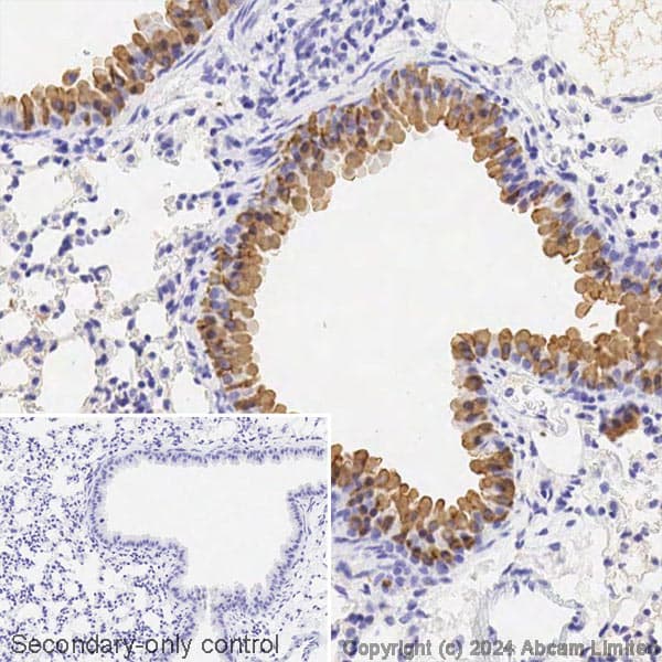 Avidin/Biotin Blocking Kit(ab64212)