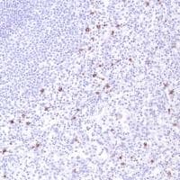 Anti-CD14 antibody [SP192](AB183322)