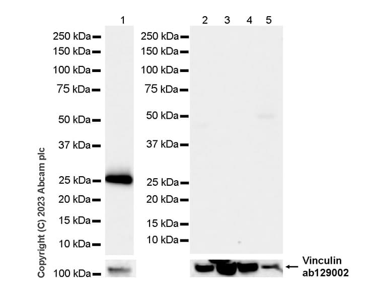 Anti-Neutrophil Elastase antibody [RM1077](AB314916)
