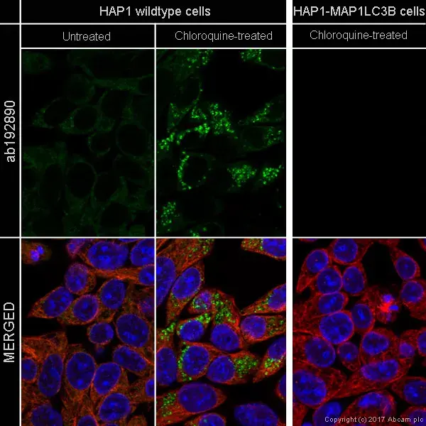 Anti-LC3B antibody [EPR18709] - Autophagosome Marker(AB192890)