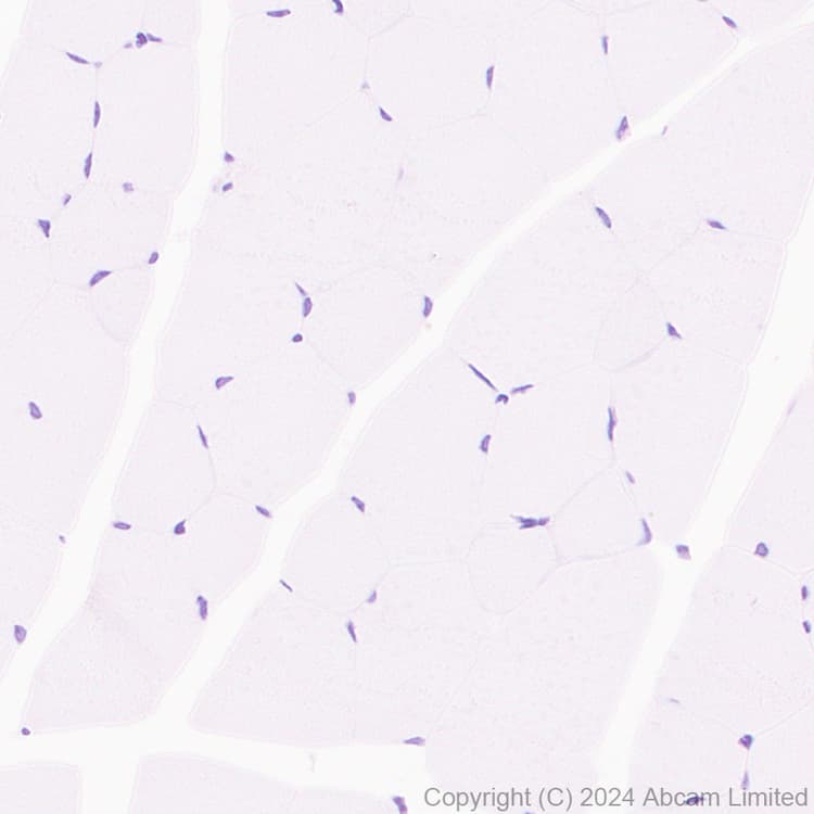 Anti-TOX antibody [EPR28108-10](ab322259)