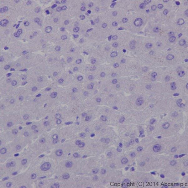 Anti-Insulin antibody [EPR17359](AB181547)