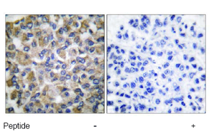 Anti-Grp75/MOT antibody(AB53098)
