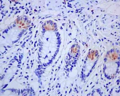 Alpha Defensin 5 Antibody Epr14309b Ab180515  Immunohistochemistry Formalin Pfa Fixed Paraffin Embedded Sections Img132159
