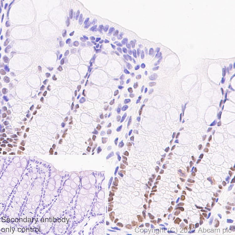 Anti-UBR7 antibody [EPR26170-67]