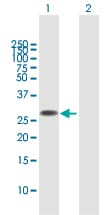 Fam60a Antibody Ab167180  Western Blot Img151044
