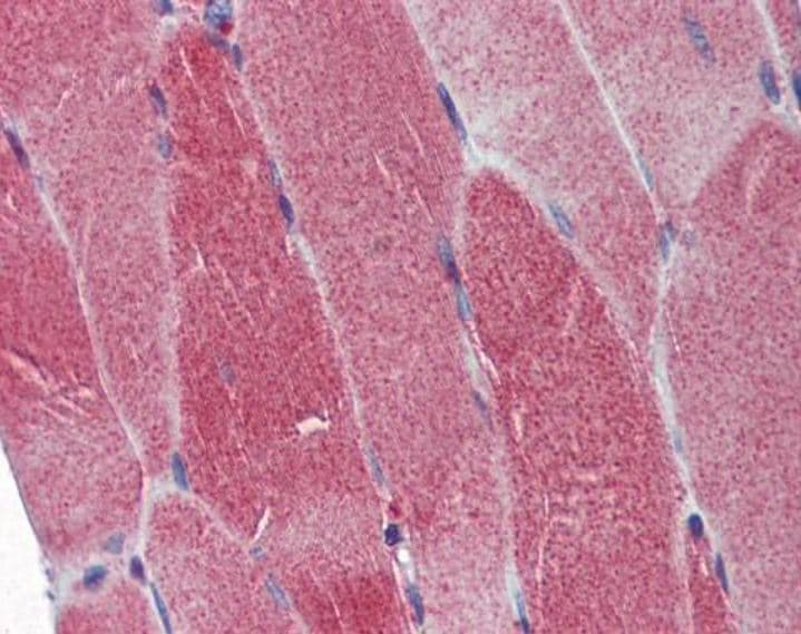 Polg Antibody Ab97661  Immunohistochemistry Formalin Pfa Fixed Paraffin Embedded Sections Img110344
