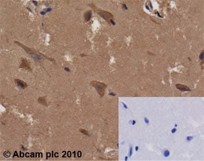 Amf Antibody 1b7d7 Ab66340  Immunohistochemistry Formalin Pfa Fixed Paraffin Embedded Sections Img40273