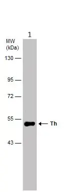 Anti-Tyrosine Hydroxylase antibody(AB137721)