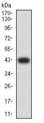 Anti-Ctip2 antibody [1F8G8](AB233713)
